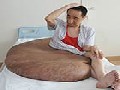 http://www.inspirefusion.com/worlds-largest-tumor-removed-from-mans-back-in-china/