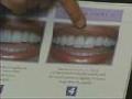 Santa Barbara Teeth Whitening - 93101