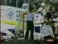 One of the worst Ice Hockey freak acidents