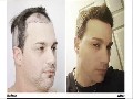 /0012edbcef-the-forhair-clinic-hair-restoration-in-atlanta-ga