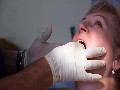 /b2da5adbab-permanent-dentures-at-west-lakes-dentistry