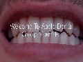 /8a8467b17e-apple-dental-group-affordable-all-on-four-dental-implants