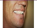 /ebaa4e8265-certified-dentist-at-red-cliffs-family-dentist-st-george-ut