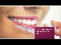 /ade80621bf-mancia-orthodontics-invisalign-miami