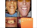 Jose J. Alvarez, DMD & Associates : Dentist in North Miami B