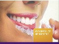 Mancia Orthodontics Miami FL - Invisalign Braces