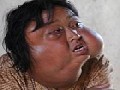 http://www.inspirefusion.com/chinese-woman-with-disfigured-face/