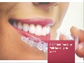 Invisalign in Miami : Mancia Orthodontics