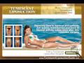 Tumescent Liposuction # 4